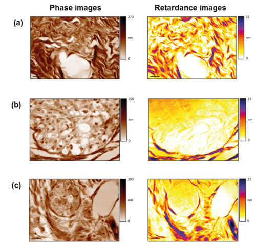 Quantitative Phase Imaging camera from Phasics is used with polarized illumination to measure birefringence in biological sample