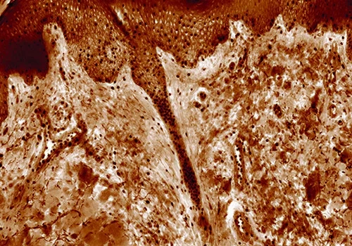 High contrast generated in quantitative phase images of unstained tissues